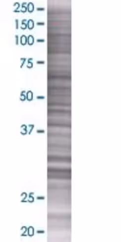 Rbm11 293t cell transient overexpre ssion lysate (denatured) 100 µl