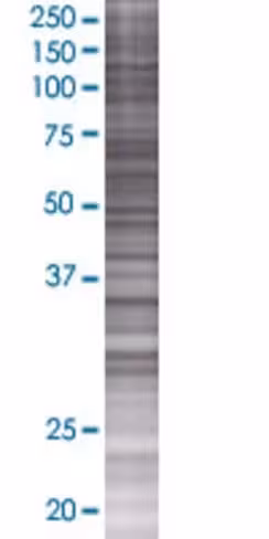 Pcbp3 293t cell transient overexpre ssion lysate (denatured) 100 µl
