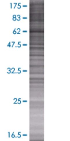 Asnsd1 293t cell transient overexpr ession lysate (denatured) 100 µl