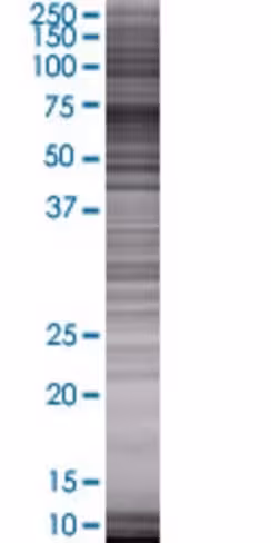P4htm 293t cell transient overexpre ssion lysate (denatured) 100 µl