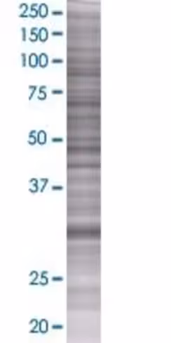 Qpctl 293t cell transient overexpre ssion lysate (denatured) 100 µl