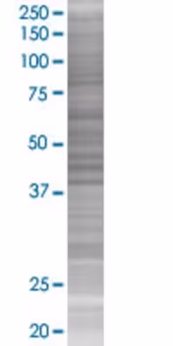 Aspn 293t cell transient overexpres sion lysate (denatured) 100 µl