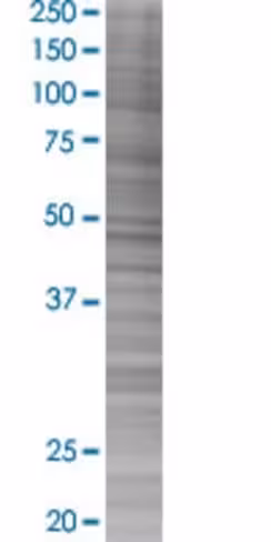 Nup62cl 293t cell transient overexp ression lysate (denatured) 100 µl