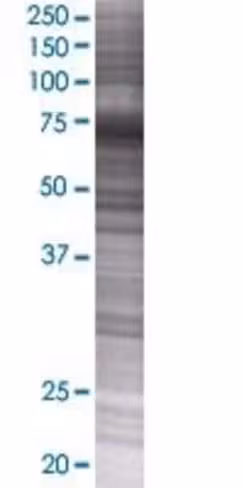 Rbm35a 293t cell transient overexpr ession lysate (denatured) 100 µl