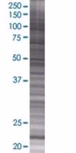Pgpep1 293t cell transient overexpr ession lysate (denatured) 100 µl
