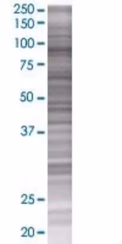 Qrich1 293t cell transient overexpr ession lysate (denatured) 100 µl