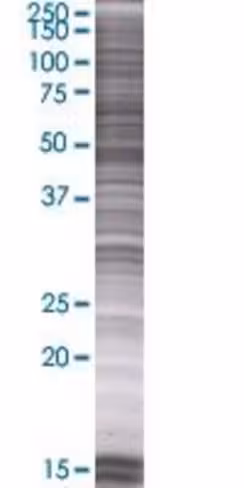 Pxk 293t cell transient overexpress ion lysate (denatured) 100 µl