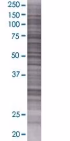 Odam 293t cell transient overexpres sion lysate (denatured) 100 µl