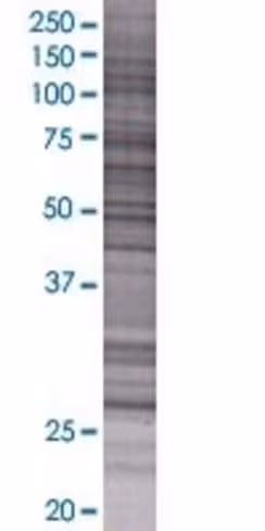Plekhb2 293t cell transient overexp ression lysate (denatured) 100 µl