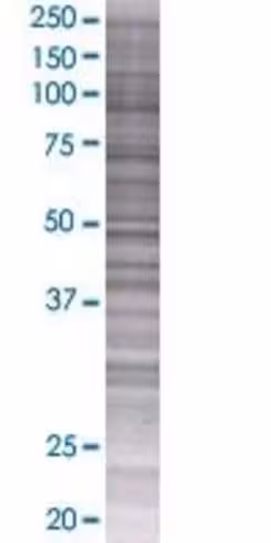 Plekhb2 293t cell transient overexp ression lysate (denatured) 100 µl