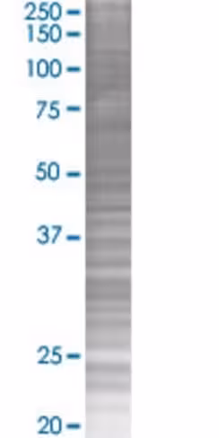 Ralgps2 293t cell transient overexp ression lysate (denatured) 100 µl