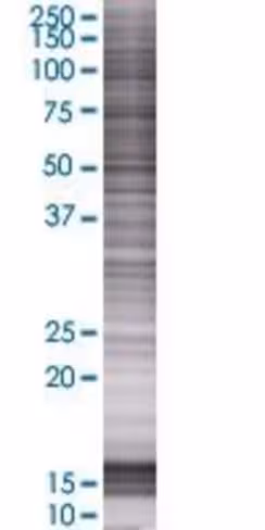 Plekhj1 293t cell transient overexp ression lysate (denatured) 100 µl