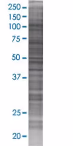 Piwil2 293t cell transient overexpr ession lysate (denatured) 100 µl