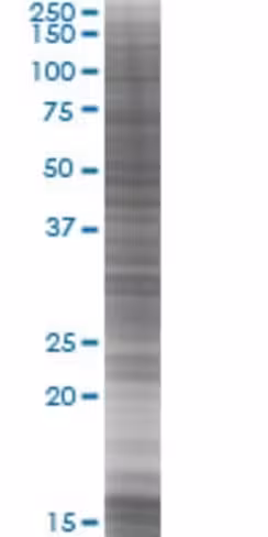 Rbm23 293t cell transient overexpre ssion lysate (denatured) 100 µl