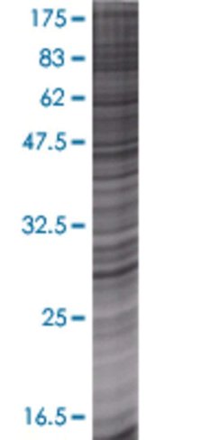 Pnpo 293t cell transient overexpres sion lysate (denatured) 100 µl