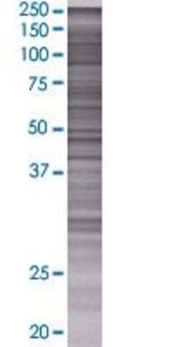 Atad3a 293t cell transient overexpr ession lysate (denatured) 100 µl