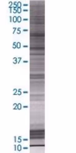 Pank4 293t cell transient overexpre ssion lysate (denatured) 100 µl