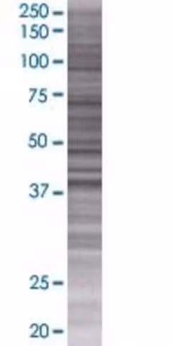 Pcmtd2 293t cell transient overexpr ession lysate (denatured) 100 µl
