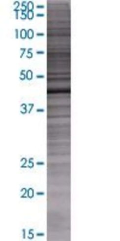 Asxl2 293t cell transient overexpre ssion lysate (denatured) 100 µl