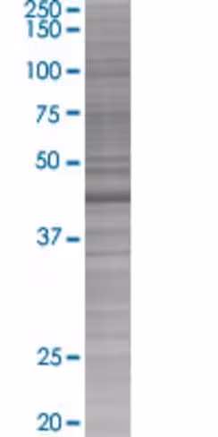Asxl2 293t cell transient overexpre ssion lysate (denatured) 100 µl
