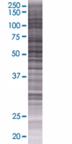 Qrsl1 293t cell transient overexpre ssion lysate (denatured) 100 µl