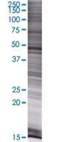 Rbm41 293t cell transient overexpre ssion lysate (denatured) 100 µl