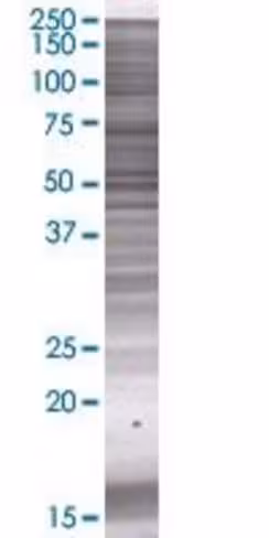 Pi4kii 293t cell transient overexpr ession lysate (denatured) 100 µl