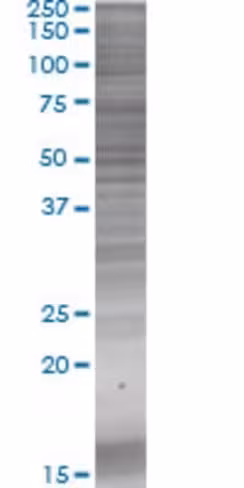 Pi4kii 293t cell transient overexpr ession lysate (denatured) 100 µl