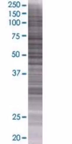 Prpf40a 293t cell transient overexp ression lysate (denatured) 100 µl