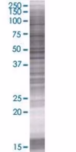 Pex26 293t cell transient overexpre ssion lysate (denatured) 100 µl