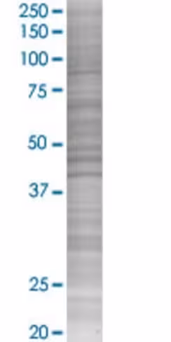 Pex26 293t cell transient overexpre ssion lysate (denatured) 100 µl