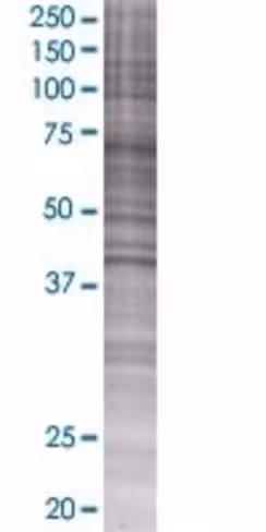 Rag1ap1 293t cell transient overexp ression lysate (denatured) 100 µl