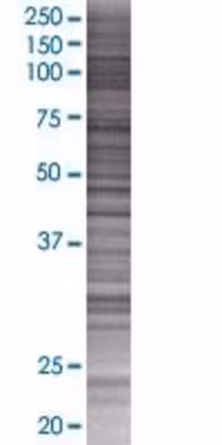 Pcdhgb1 293t cell transient overexp ression lysate (denatured) 100 µl