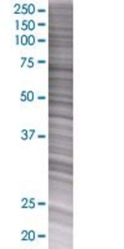 Pcdhb7 293t cell transient overexpr ession lysate (denatured) 100 µl