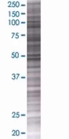 Pcdhb6 293t cell transient overexpr ession lysate (denatured) 100 µl