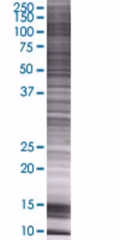 Pcdha6 293t cell transient overexpr ession lysate (denatured) 100 µl