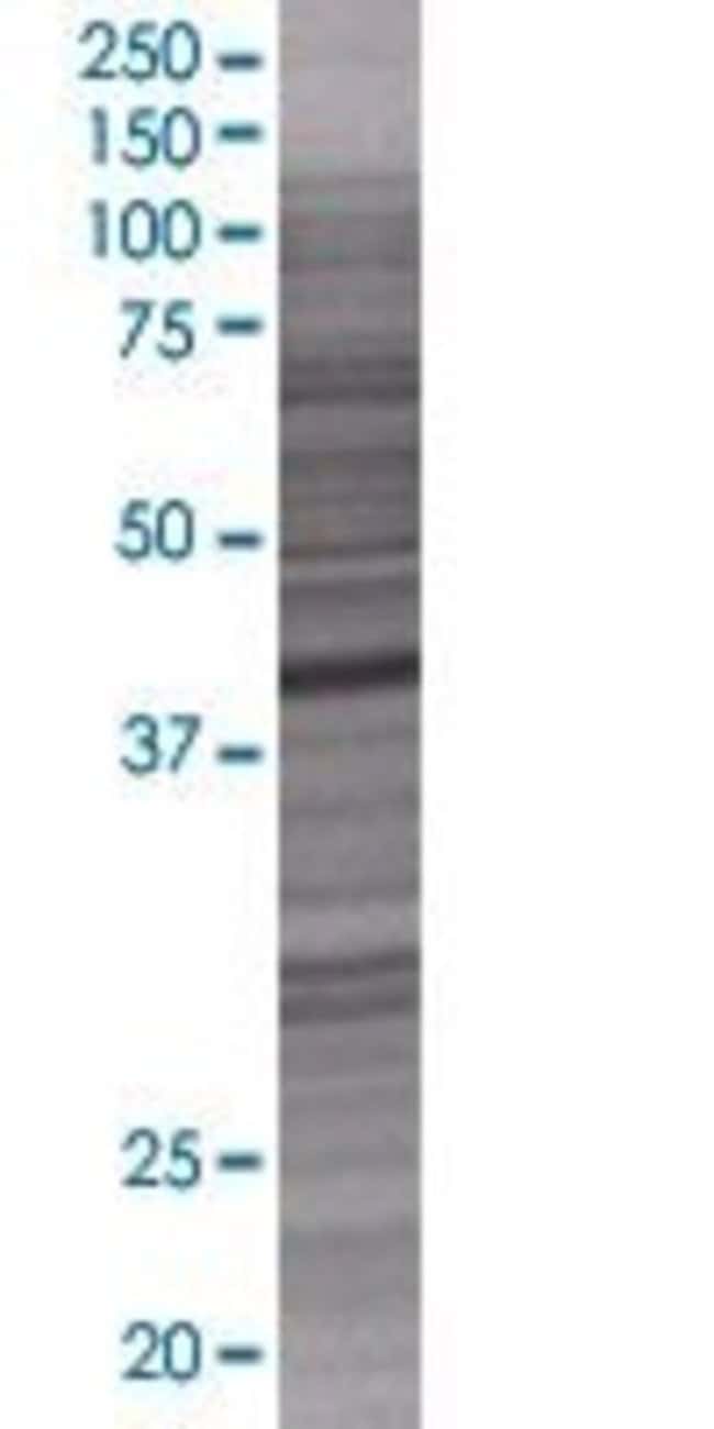 Prmt8 293t cell transient overexpre ssion lysate (denatured) 100 µl