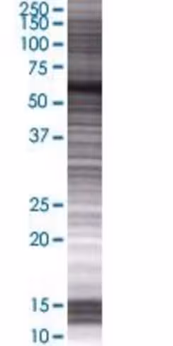 Rad18 293t cell transient overexpre ssion lysate (denatured) 100 µl