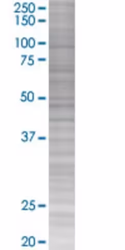 Rad18 293t cell transient overexpre ssion lysate (denatured) 100 µl