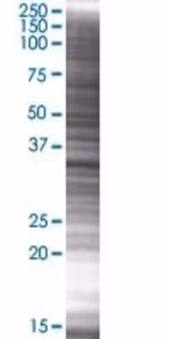 Plscr4 293t cell transient overexpr ession lysate (denatured) 100 µl