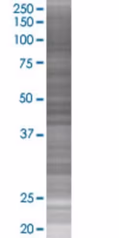 Plscr4 293t cell transient overexpr ession lysate (denatured) 100 µl