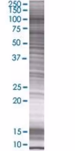 Pbxip1 293t cell transient overexpr ession lysate (denatured) 100 µl