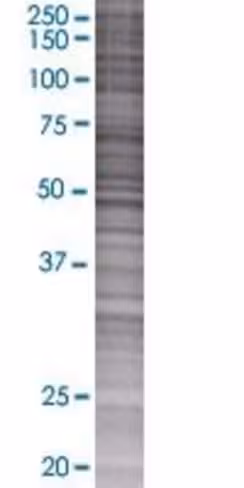 Pdp2 293t cell transient overexpres sion lysate (denatured) 100 µl