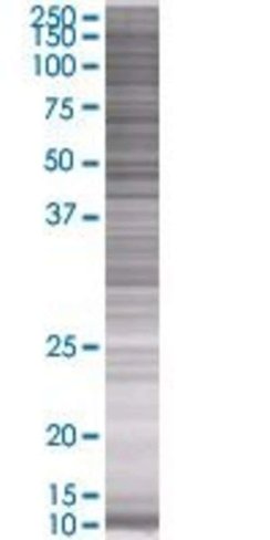 Pcdhb16 293t cell transient overexp ression lysate (denatured) 100 µl