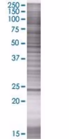 Pctp 293t cell transient overexpres sion lysate (denatured) 100 µl