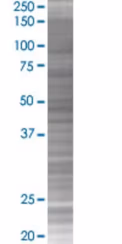 Pctp 293t cell transient overexpres sion lysate (denatured) 100 µl