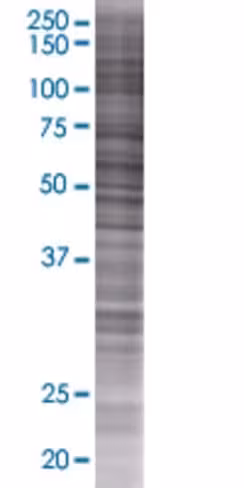 Prune 293t cell transient overexpre ssion lysate (denatured) 100 µl