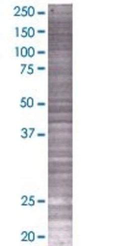 Plekha1 293t cell transient overexp ression lysate (denatured) 100 µl