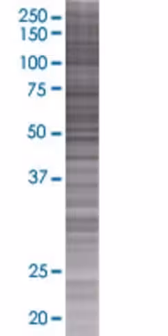 Oxct2 293t cell transient overexpre ssion lysate (denatured) 100 µl