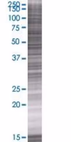 Rbks 293t cell transient overexpres sion lysate (denatured) 100 µl
